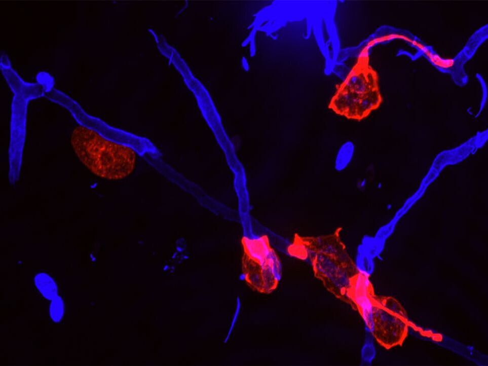 The image visualises the behaviour of amoebae that attach themselves to fungal filaments in order to kill them. The amoebae glow red, while the fungal filaments are shown in blue, which makes their interaction visible under the microscope.